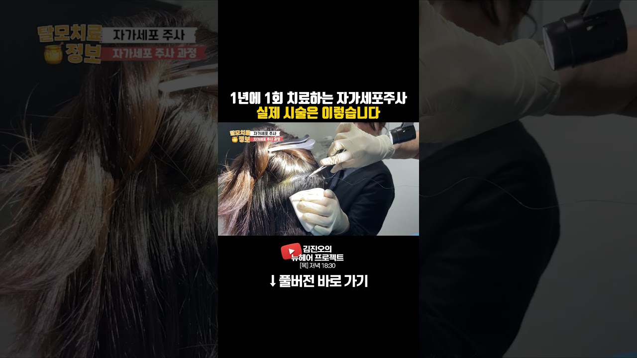 1年治疗1次的自体细胞注射实际手术如下。