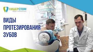 Виды протезирования зубов 👐 Подробно о всех видах и этапах протезирования зубов