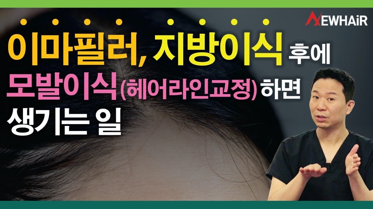 모발이식생착률!? 이마필러, 지방이식하고 헤어라인교정하면 클릭ㅣ뉴헤어