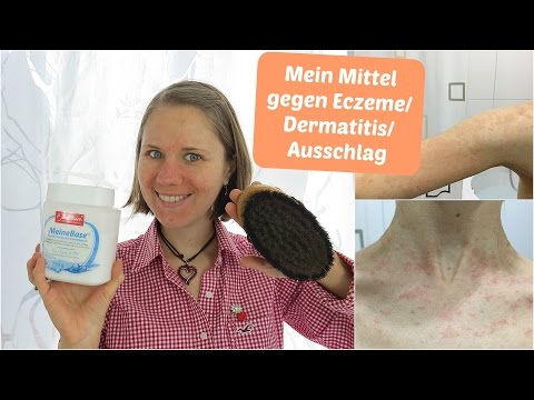 Die Schuppenflechte auf den intimen Stellen des Grundes des Erscheinens Die Salbe bei nejrodermite die Preise