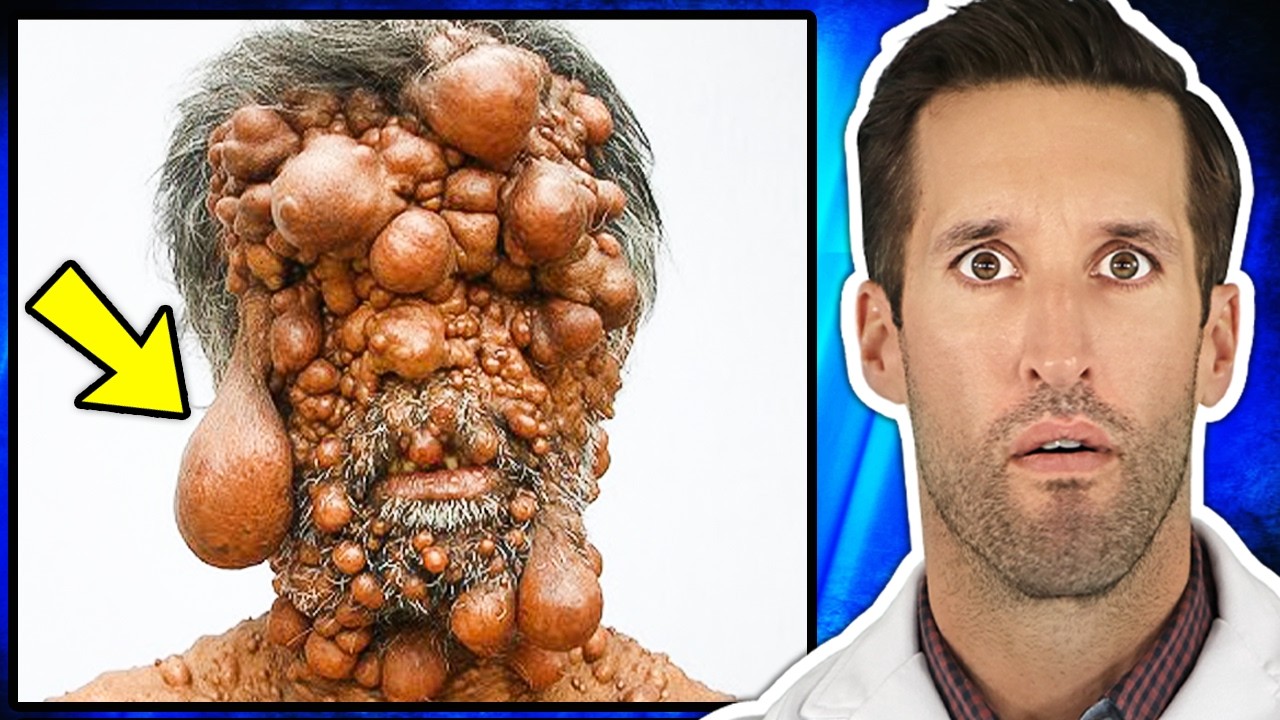 ER Doctor REACTS to World's Rarest Diseases (PART 2)