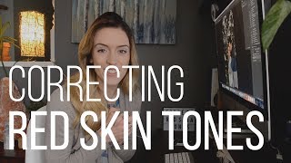 Photoshop Tutorial: Remove and Retouch Redness in Skin Tone