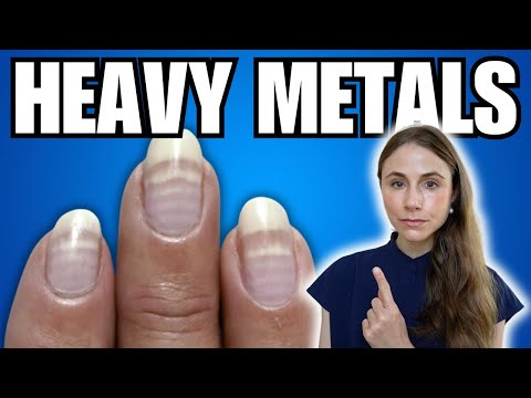5 Warning Signs Of Heavy Metal Toxicity NOT TO MISS
