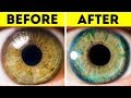 7 Things That Can Change Your Eye Color