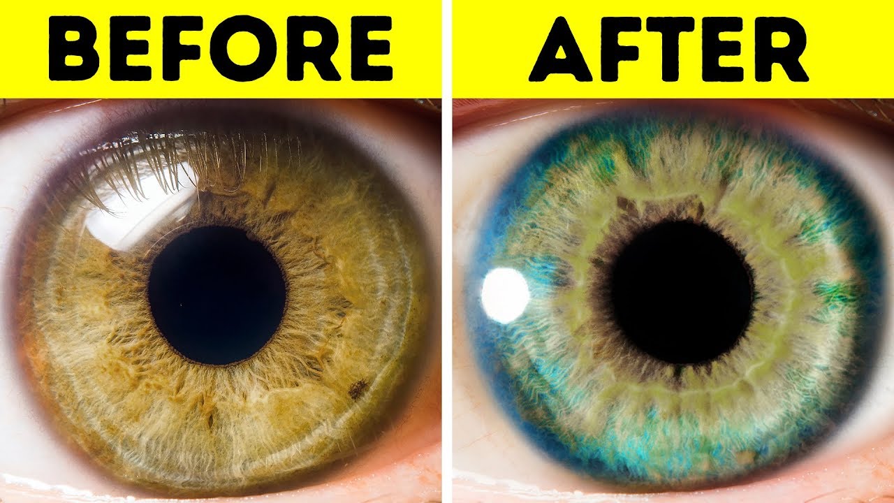 What emotions can change your eye color? Wiki REF
