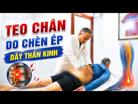 Tại Sao Chèn Ép Dây Thần Kinh Gây Teo Chân? Dấu Hiệu Không Nên Chủ Quan!