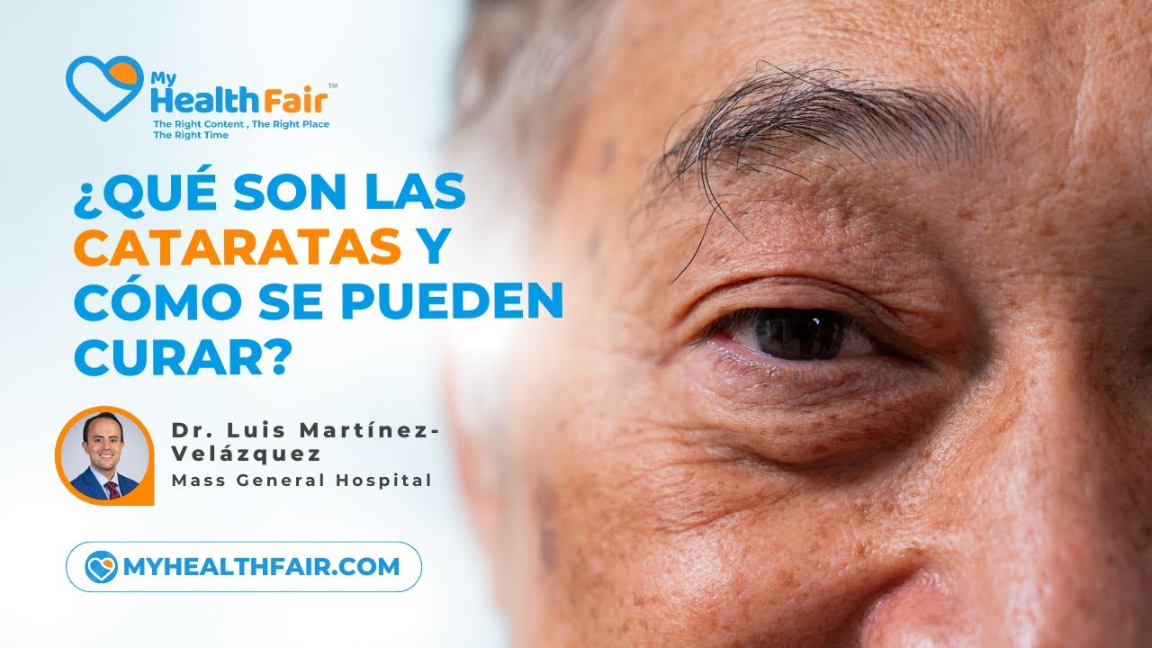 Un Problema Común de la vista: ¿Qué Son las Cataratas y Cómo se Pueden Curar?