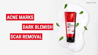 Download lagu Benefits of Snail Truecica Miracle Repair Low pH Gel Cleanser mp3 Download lagu Benefits of Snail Truecica Miracle Repair Low pH Gel Cleanser mp3