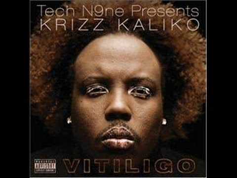 Video thumbnail for Vitiligo