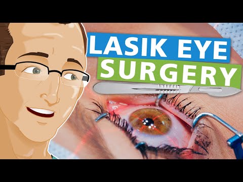 Lasik Eye Surgery