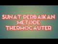 SUNAT PERBAIKAN METODE DORSUMSISI CIRCUMSISI DENGAN THERMOCAUTER