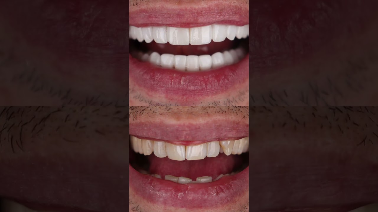 Esteban De Jesús Morelo Galvan-4