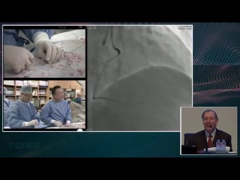 [CTO LIVE 2016] Live Case Session II