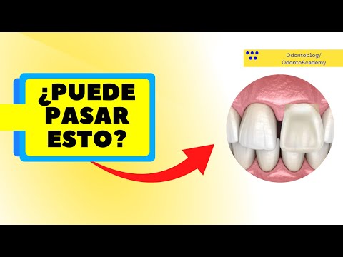 ¿Puede pasar esto?