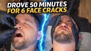 Snoring Patient Gets His Face Cracked for the First Time 🤯