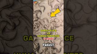 Download lagu It Turns Out Parasites Are Defeated by Garlic!! mp3