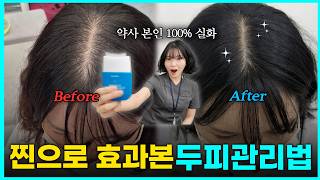(눈물주의) 100시간 일하다가 대머리 될 뻔한 약사의 탈모 극복기 ㅣ60대 남성 4주 찐 후기 다수 보유 | 헤어앰플을 곁들인....