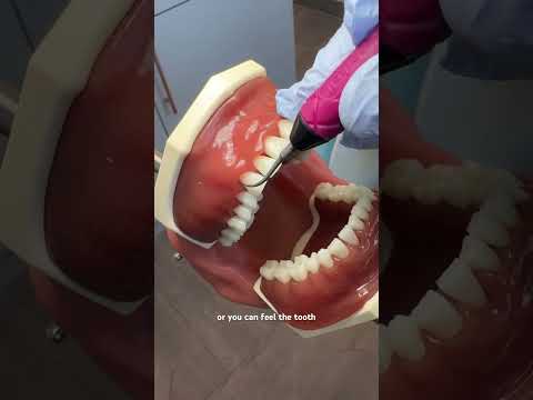 How much of the ultrasonic tip should be touching the tooth? #dentalhygiene #dentalhygienestudent