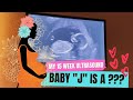 15 Week Ultrasound + Gender Reveal?