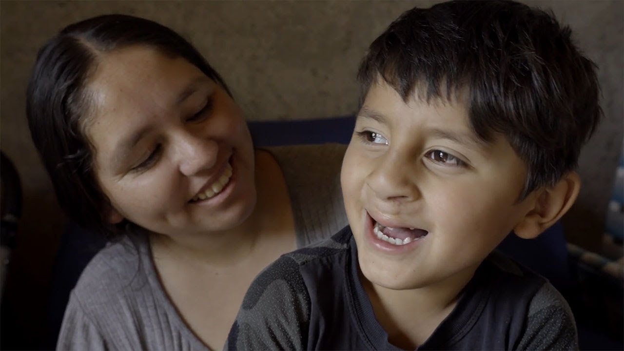 Comprehensive Cleft Care Helps Ezequiel Shine