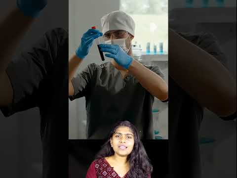 എന്താണ് Horse Anti Venom 😱