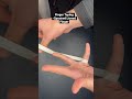 Finger Taping - Sprained/ Jarred Finger #taping #physicaltherapy #strapping #sporttape #sportstaping