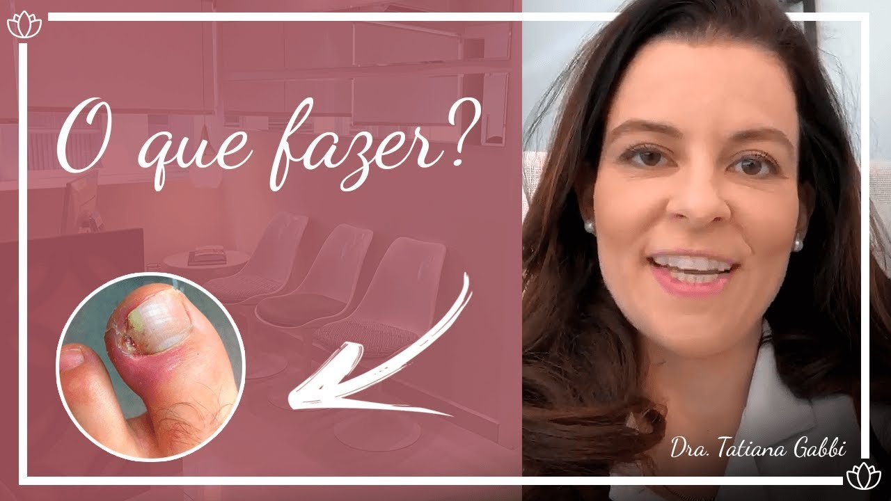Unha encravada após machucar o dedo. O que fazer ?