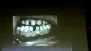 2_Dr.Faisal  - Apoptosis and Necrosis part 7