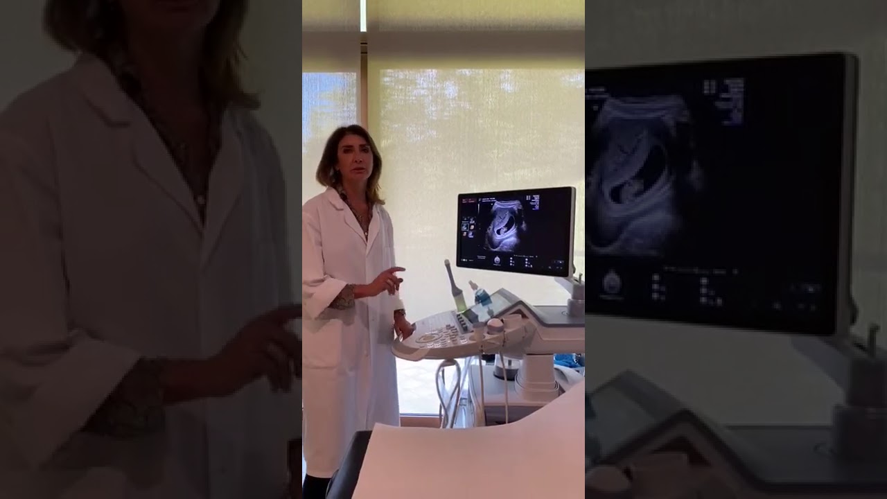 La prima ecografia in gravidanza, tutto quello che dobbiamo sapere. #shorts