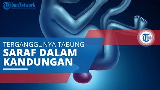 Spina Bifida, Kondisi Cacat Lahir akibat Terganggunya Pembentukan Tabung Saraf saat dalam Kandungan