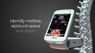 Accuro for Neuraxial Anesthesia Epidural Guidance