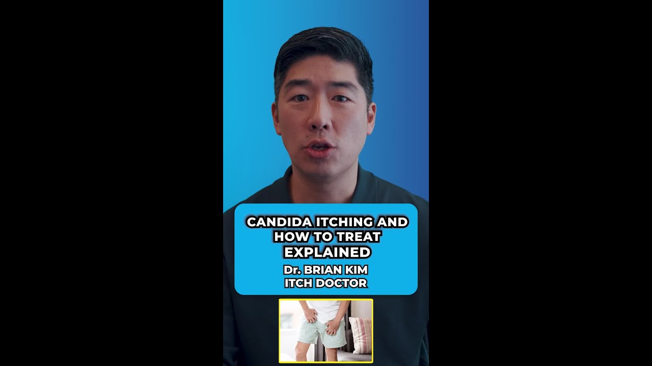 Candida Itching and How To Treat It