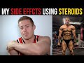 My Side Effects from using Steroids