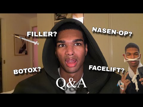 I had all of that done – finally Q&A time again!