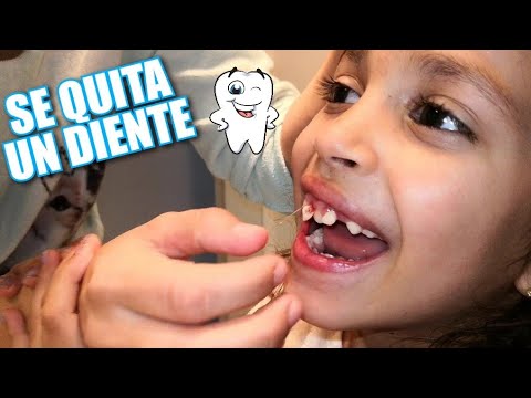 DIENTES DE LECHE como quitarlo sin dolor