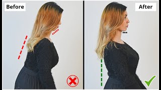 Just 3 Steps To Fix Your Posture Permanently- No Exercise/No Secret Formula- Get Rid of Poor Posture