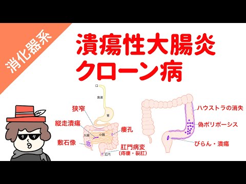 細菌性栗潰瘍 - 定義