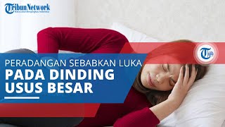 Radang Usus, Peradangan yang Lama Sebabkan Luka pada Lapisan Dinding Usus Besar, Kolon, dan Rektum