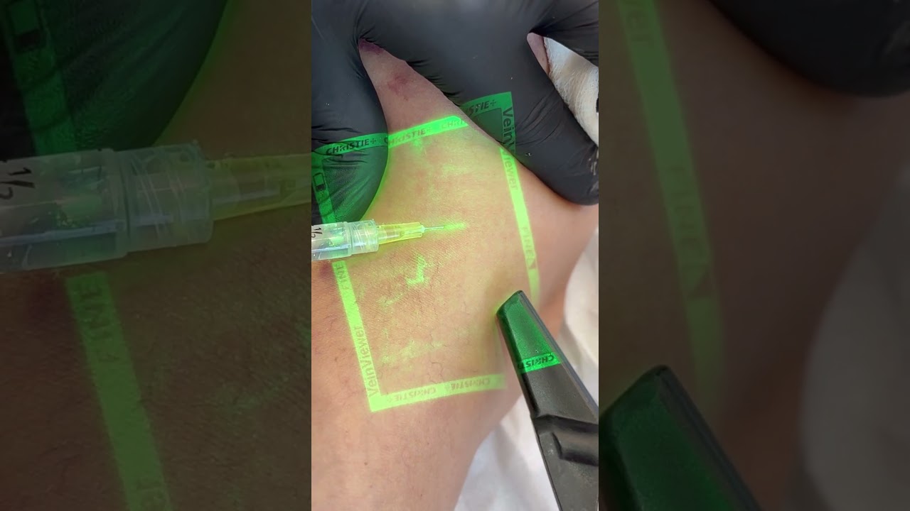 Adbeel Franco Barbosa-29