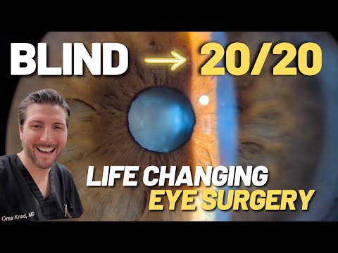 Patient Interview after Life-Changing Cataract Surgery