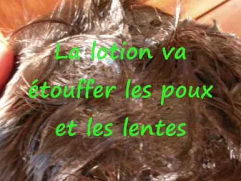 comment traiter poux et lentes