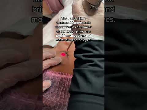 Brighter, smoother, and more rejuvenated eyes with the Panda Eyes treatment.