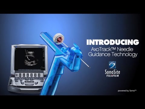AxoTrack™ Needle Guidance Technology Demonstration - Sonosite Ultrasound