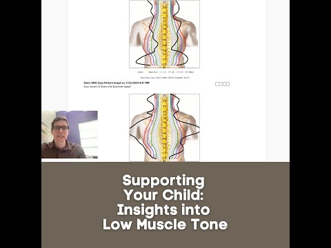 Supporting Your Child: Insights into Low Muscle Tone