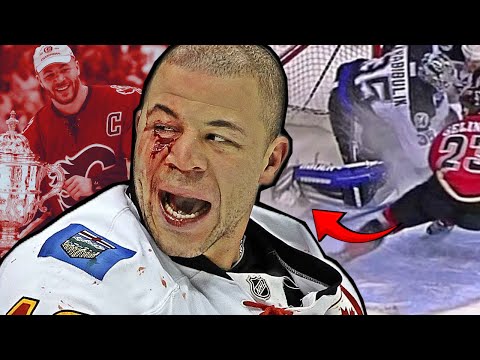 He Was so Close to Glory…But Got Heartbreak Instead