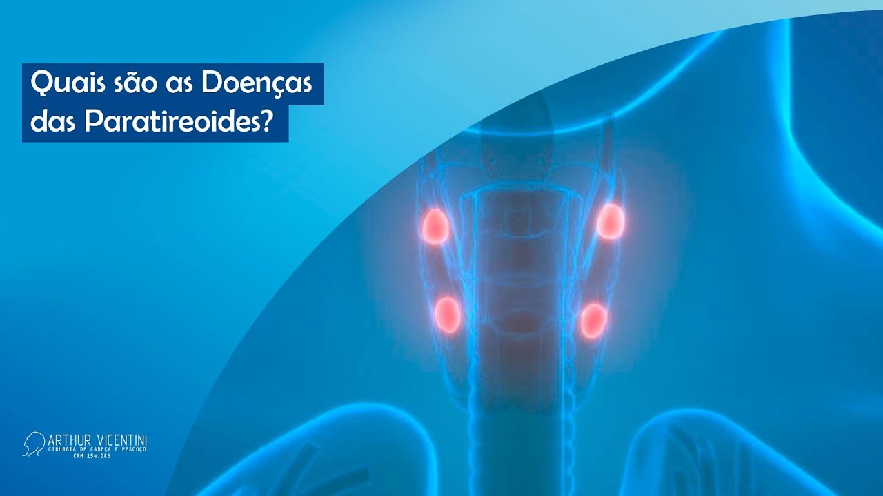 Quais são as Doenças das Paratireoides? | Dr. Arthur Vicentini CRM 154.086