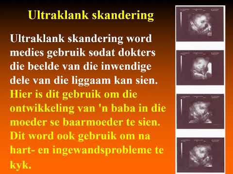 Klankgolwe eienskappe: weerkaatsing toonhoogte volume gr 10 Fisika
