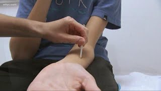 Study: Millions who think they are allergic to penicillin really aren't
