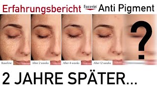 Pigmentflecken Update nach 2 Jahren Eucerin #AntiPigment | + Emotionale Story Haut blutig weggeätzt