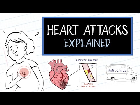 What is a Heart Attack? (HealthSketch)